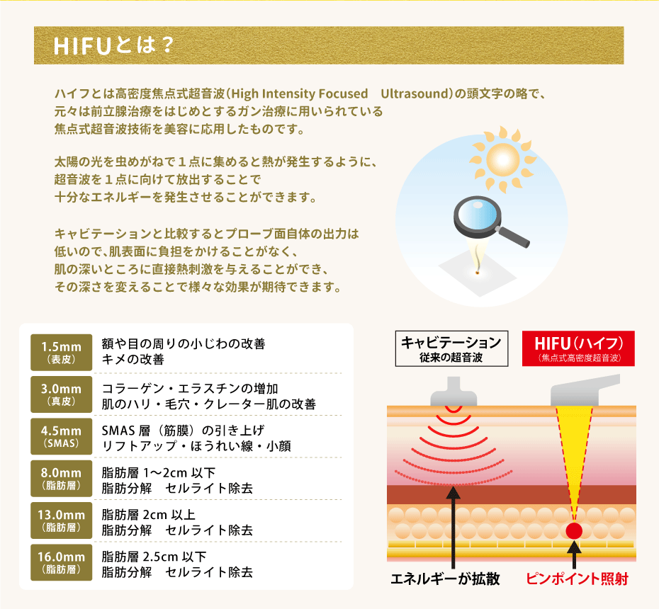 【HIFU（ハイフ）とは？】ハイフとは高密度焦点式超音波（High Intensity Focused　Ultrasound）の頭文字の略で、元々は前立腺治療をはじめとするガン治療に用いられている焦点式超音波技術を美容に応用したものです。太陽の光を虫めがねで１点に集めると熱が発生するように、超音波を１点に向けて放出することで十分なエネルギーを発生させることができます。キャビテーションと比較するとプローブ面自体の出力は低いので、肌表面に負担をかけることがなく、肌の深いところに直接熱刺激を与えることができ、その深さを変えることで様々な効果が期待できます。【1.5mm（表皮）】額や目の周りの小じわの改善 キメの改善【3.0mm（真皮）】コラーゲン・エラスチンの増加 肌のハリ・毛穴・クレーター肌の改善【4.5mm（SMAS）】SMAS層（筋膜）の引き上げ リフトアップ・ほうれい線・小顔【8.0mm（脂肪層）】脂肪層1〜2cm以下 脂肪分解　セルライト除去【13.0mm（脂肪層）】脂肪層2cm以上 脂肪分解　セルライト除去【16.0mm（脂肪層）】脂肪層2.5cm以下 脂肪分解　セルライト除去【 キャビテーション・従来の超音波】・・・エネルギーが拡散　【 HIFU（ハイフ）（焦点式高密度超音波）】・・・ピンポイント照射