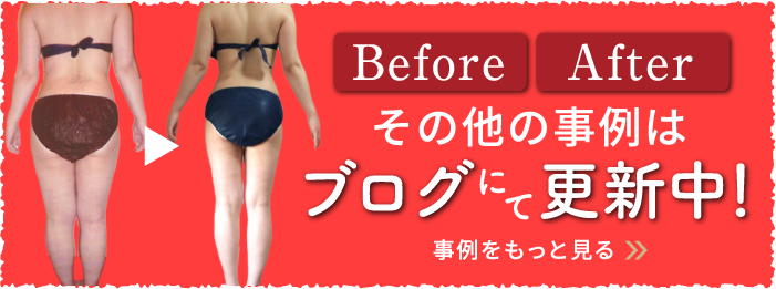 BeforeAfter その他の事例はブログにて更新中！事例をもっと見る